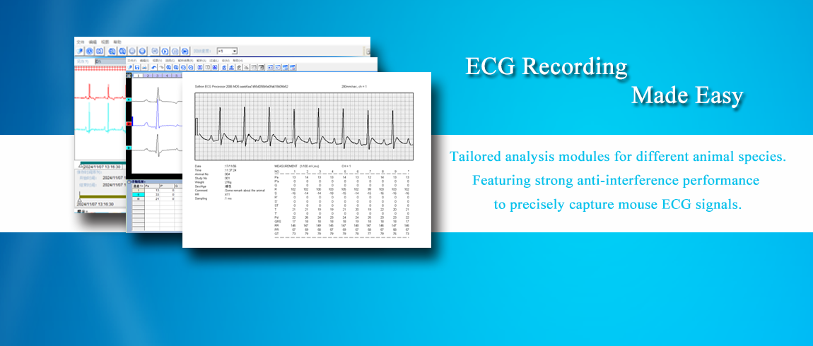 ECG Acquisition